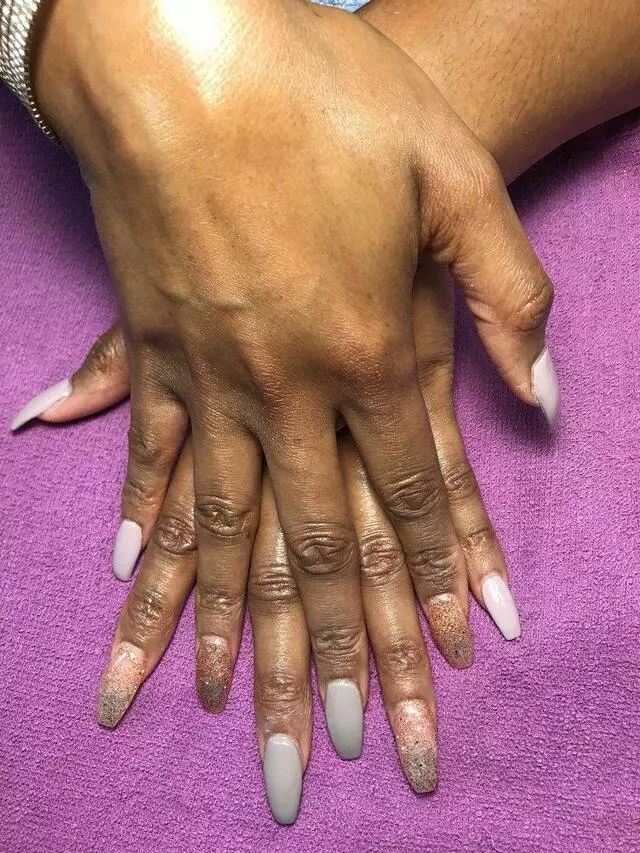 All Nails