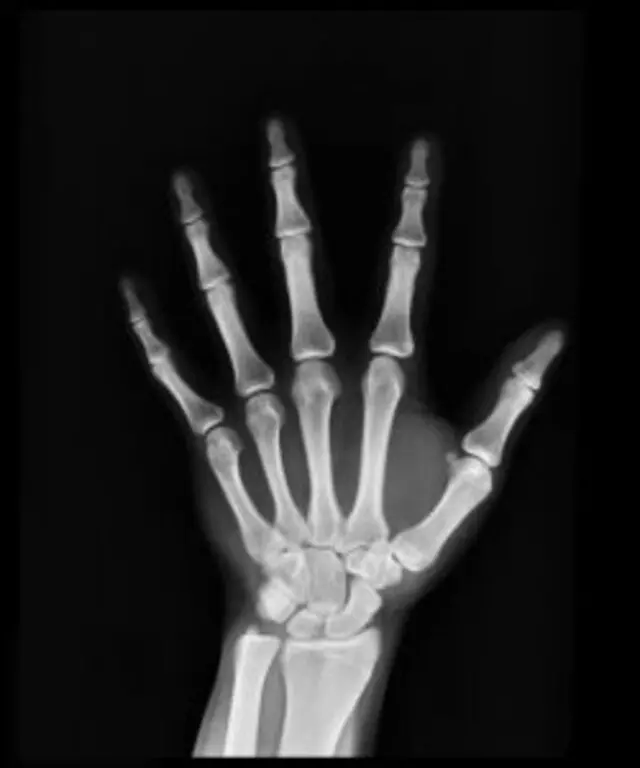 Absolute Chiropractic Care