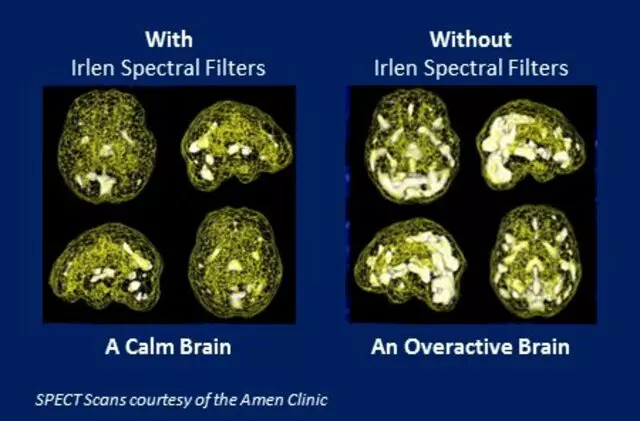 Abilities OT & Irlen Diagnostic Center