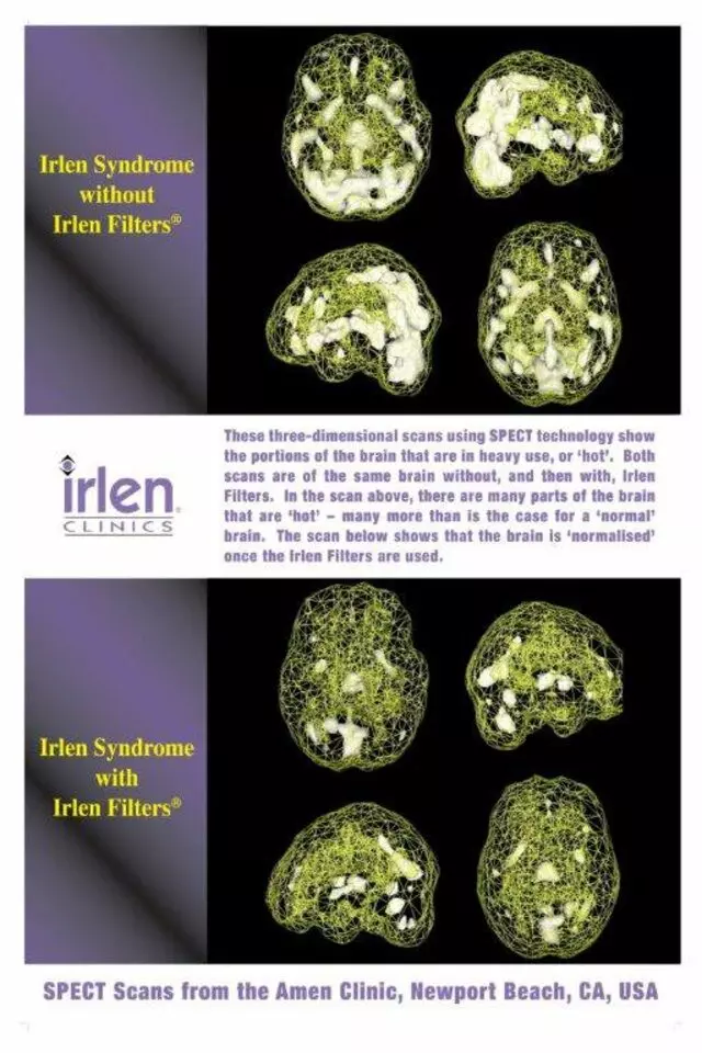 Abilities OT & Irlen Diagnostic Center